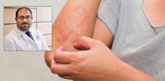 Ψωρίαση: Πόσο επικίνδυνη είναι;