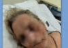 Άγριος ξυλοδαρμός ηλικιωμένης από αποκλειστική νοσοκόμα