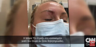 Θυμίζει και… εφιάλτη: Φίδι δάγκωσε γυναίκα στο πρόσωπο (video)