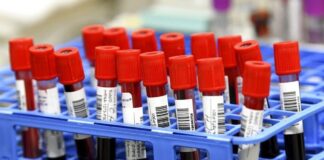 ΙΣΑ: Σύσταση για εμβολιασμό των ευπαθών ομάδων έναντι της covid-19, της γρίπης και του πνευμονιόκκοκου από τον θεράποντα γιατρό