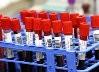 Διπλάσιος ο κίνδυνος long Covid στα παιδιά έπειτα από δεύτερη μόλυνση